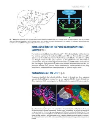 New liver anatomy―Portal segmentation New Liver Anatomy Portal Segmentation And The Drainage Vein 2009th