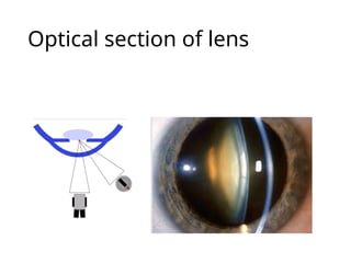 Optical section of lens
 