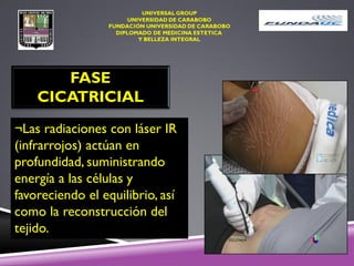 FASE
CICATRICIAL
¬Las radiaciones con láser IR
(infrarrojos) actúan en
profundidad, suministrando
energía a las células y
favoreciendo el equilibrio, así
como la reconstrucción del
tejido.
 