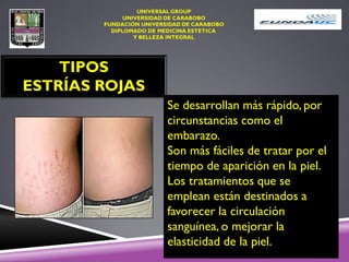 TIPOS
ESTRÍAS ROJAS
Se desarrollan más rápido, por
circunstancias como el
embarazo.
Son más fáciles de tratar por el
tiempo de aparición en la piel.
Los tratamientos que se
emplean están destinados a
favorecer la circulación
sanguínea, o mejorar la
elasticidad de la piel.
 