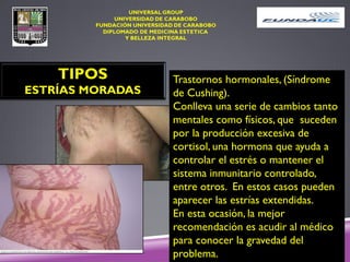 TIPOS
ESTRÍAS MORADAS
Trastornos hormonales, (Síndrome
de Cushing).
Conlleva una serie de cambios tanto
mentales como físicos, que suceden
por la producción excesiva de
cortisol, una hormona que ayuda a
controlar el estrés o mantener el
sistema inmunitario controlado,
entre otros. En estos casos pueden
aparecer las estrías extendidas.
En esta ocasión, la mejor
recomendación es acudir al médico
para conocer la gravedad del
problema.
 