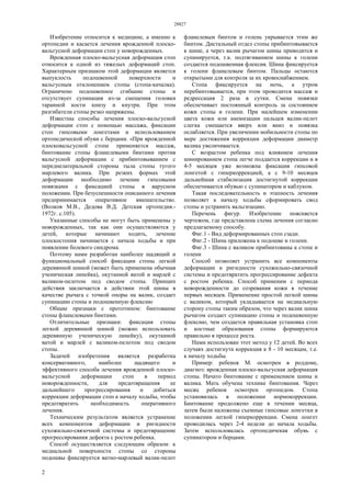 24296 | Схема изготовления ватно-марлевой повязки | k0shmar | Flickr