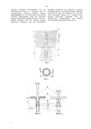 28865
4
передняя (торцовая) направляющая зона (А)
заканчивается конусом, а последняя зона D
соединительного элемента образует шляпку,
отличающийся тем, что в оболочке (1) над нижней
торцовой направляющей зоной (А) находится
средняя переходная распорная зона (В), а над ней -
верхняя клиновая зона (С), причем средняя
переходная распорная зона (В) посредством
разрывных перемычек (6) соединена с верхней
клиновой зоной (С), в которой находятся клиновые
пластинки (7), при этом оболочка (1) в зоне (В)
имеет распорный прилив (3), а верхняя часть
средней переходной распорной зоны (В)
заканчивается направляющей (10), причем
пластмассовый штырь короче оболочки (1).
 