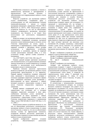 28997
2
Изобретение относится к медицине, а именно к
травматологии, ортопедии и ортезированию и
предназначено для лечения больных с
заболеваниями или повреждениями шейного отдела
позвоночника.
Известно устройство для вытяжения шейного
отдела позвоночника, содержащее раму с
установленными на ней неподвижными блоками
взаимодействующими с тросам и элемент
вытяжения связанный с динаметром /Патент CRUA
№2633124 кл 128-75, 1955/ Недостатком данного
устройства является то, что оно не обеспечивает
плавного дозированного вытяжения, исключает
подвижность для больного и не может быть
использовано для длительного, непрерывного
лечения.
Известен аппарат для вытяжения шейного отдела
позвоночника, содержащий основание, вытяжной
механизм в виде пневмоцилиндра со штоком, петлю
Глиссона закрепленную на штоке, грушу с
манометром и трубопроводом, стойку снабженную
шаровой головкой с фигурным пазом которая
установлена в сфирическом углублении,
выполненном в основании, причем на шаровой
головке расположена накидная гайка, а в пазу
установлен штифт, причем стойка соединена с
основанием.
/А.с. ССР 760971, А61F 5/04, 1981, бюл.27/
Однако, данный аппарат причиняет неудобства
для лечения больного, из-за расположения основных
звеньев механизма по задней поверхности туловища
неудобен в эксплуатации из-за необходимости
подкачивать воздух в пневмоцилиндр.
Наиболее близким аналогом (прототипом)
является устройство для вытяжения шейного отдела
позвоночника представленное в 2-х вариантах.
Первый вариант устройства содержит нагрудной
пояс, связанный с наплечниками, на которых с
помощью шарниров закреплено основание в форме
арки, снабженное винтовым узлом вытяжения с
расположенной на винте пружиной с гайкой,
который соединен с фиксатором головки в виде
петли Глиссона посредством коромысла и
динаметра.
Второй вариант содержащий дуги и пояс с
держателями для установки дуг к которым
шарнирно закреплено основание в виде арки,
снабженное винтовым узлом вытяжения с
расположенной на винте пружиной с гайкой,
соединенным с фиксатором головы в виде петли
Глиссона посредством коромысла и динамометра
/Пред. патент 3965 КZ (В) (11) А61F 5/01 бюл. 4, 16.
12. 1996 г./
Недостатком данного устройства является то, что
оно не обеспечивает раздельного, ассиметричного
вытяжения шейного отдела позвоночника за лямки
петли Глиссона, а также то, что оно не обеспечивает
наклона головы во фронтальной плоскости,
устройство является достаточно громоздким и
нестабильным в процессе осуществления вытяжения
шейного отдела позвоночника.
Задачей изобретения является создание
устройства, обеспечивающего длительное
вытяжение шейного отдела позвоночника с
различными углами наклона во фронтальной и
сагиттальной плоскостях, дозированное, плавное и
раздельное вытяжение за лямки на петле Глиссона,
удобство для лежания и ходьбы больного.
Технический результат достигается тем, что
устройство для вытяжения шейного отдела
позвоночника содержит корсет или полукорсет (1),
связанный с наплечниками (2), на которых с
помощью сферических шарниров (4), закреплено
основание в форме рамы (14), снабженное в
вертикальных плечах рамы (3) двумя
телескопическими (5) дистракторами, по одному на
каждое вертикальное плечо рамы, а горизонтальное
плечо рамы (7) и два вертикальных плеча рамы
соединены между собой при помощи одноосных
шарниров (6), при этом на горизонтальном плече
рамы имеются отверстия во фронтальной плоскости
(8) через которые проходят два винтовых узла
вытяжения (9), которые соединены с фиксатором
головы в виде петли Глиссона (12), раздельно за
лямки (13) петли Глиссона, а на винте узла
вытяжения расположены (6) пружина (10), и гайка
(11)
На фиг.1 изображено устройство для вытяжения
шейного отдела позвоночника, общий вид.
На фиг.2 изображен сферический шарнир
На фиг.3 изображен одноосный шарнир
На фиг.4 изображен телескопический
дистрактор.
На фиг.5 изображен узел вытяжения.
Аппарат для вытяжения шейного отдела
позвоночника содержит 1 корсет; 2 наплечники; 3
вертикальное плечо рамы; 4 сферический шарнир; 5
телескопический дистрактор; 6 одноосный шарнир;
7 горизонтальное плечо рамы; 8 отверстия на
горизонтальном плече рамы; 9 винтовой узел
вытяжения; 10 пружина; 11 гайка; 12 петля
Глиссона; 13 лямка петли Глиссона; 14 рама; 15
застежки на корсете.
Аппарат работает следующим образом.
В соответствии с медицинскими показаниями
больному изготавливается аппарат, на туловище
больного одевается полукорсет или корсет (1) и
фиксируется застежками (15), петлю Глиссона (12)
надевают на подбородок и затылок больного, лямки
(13) петли Глиссона соединяют с винтовыми узлами
вытяжения (9), путем завинчивания гаек (11)
осуществляют умеренное вытяжение, после чего
расфиксовывают сферические шарниры (4), и
одноосные шарниры (6), плечи рамы (14)
устанавливают в необходимое положение и
фиксируют. Вытяжение под необходимым углом во
фронтальной и сагиттальной плоскостях
осуществляют при помощи телескопических
дистракторов (5). Раздельное вытяжение
осуществляют винтовыми узлами вытяжения (9), за
лямки (13) петли Глиссона (12). Таким образом, в
результате такого конструктивного решения
устройства достигается возможность длительного
вытяжения шейного отдела позвоночника под
необходимым углом во фронтальной и сагиттальной
 