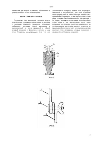 28997
3
плоскостях при ходьбе и лежании, заболеваниях и
травмах шейного отдела позвоночника.
ФОРМУЛА ИЗОБРЕТЕНИЯ
Устройство для вытяжения шейного отдела
позвоночника, содержащее наплечники, на которых
с помощью шарниров закреплено основание,
снабженное винтовым узлом вытяжения с
расположенной на винте пружиной и гайкой,
который соединен с фиксатором головы в виде
петли Глиссона, отличающееся тем, что оно
дополнительно содержит корсет, или полукорсет,
связанный с наплечниками, при этом основание
имеет форму рамы и закреплено при помощи двух
сферических шарниров, а два вертикальных плеча
рамы содержат два телескопических дистрактора, -
по одному на каждое плечо рамы; горизонтальное
плечо рамы и два вертикальных плеча рамы
соединены при помощи одноосных шарниров, а на
горизонтальном плече рамы имеются отверстия во
фронтальной плоскости, через которые проходят два
винтовых узла вытяжения, которые соединены с
лямками петли Глиссона раздельно.
 
