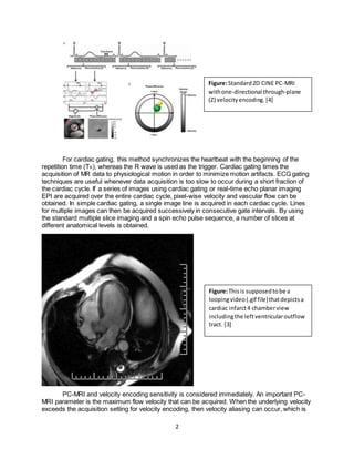 2
For cardiac gating, this method synchronizes the heartbeat with the beginning of the
repetition time (TR), whereas the R wave is used as the trigger. Cardiac gating times the
acquisition of MR data to physiological motion in order to minimize motion artifacts. ECG gating
techniques are useful whenever data acquisition is too slow to occur during a short fraction of
the cardiac cycle. If a series of images using cardiac gating or real-time echo planar imaging
EPI are acquired over the entire cardiac cycle, pixel-wise velocity and vascular flow can be
obtained. In simple cardiac gating, a single image line is acquired in each cardiac cycle. Lines
for multiple images can then be acquired successively in consecutive gate intervals. By using
the standard multiple slice imaging and a spin echo pulse sequence, a number of slices at
different anatomical levels is obtained.
PC-MRI and velocity encoding sensitivity is considered immediately. An important PC-
MRI parameter is the maximum flow velocity that can be acquired. When the underlying velocity
exceeds the acquisition setting for velocity encoding, then velocity aliasing can occur, which is
Figure:Standard2D CINE PC-MRI
withone-directional through-plane
(Z) velocityencoding. [4]
Figure:Thisis supposedtobe a
loopingvideo(.gif file)thatdepictsa
cardiac infarct4 chamberview
includingthe leftventricularoutflow
tract. [3]
 