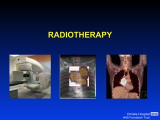 RADIOTHERAPY 
