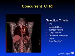 Concurrent  CTRT Selection Crit eria PS Comorbidities Tumour volume  Lung volume Dose normal tissues (age) (lung function) 