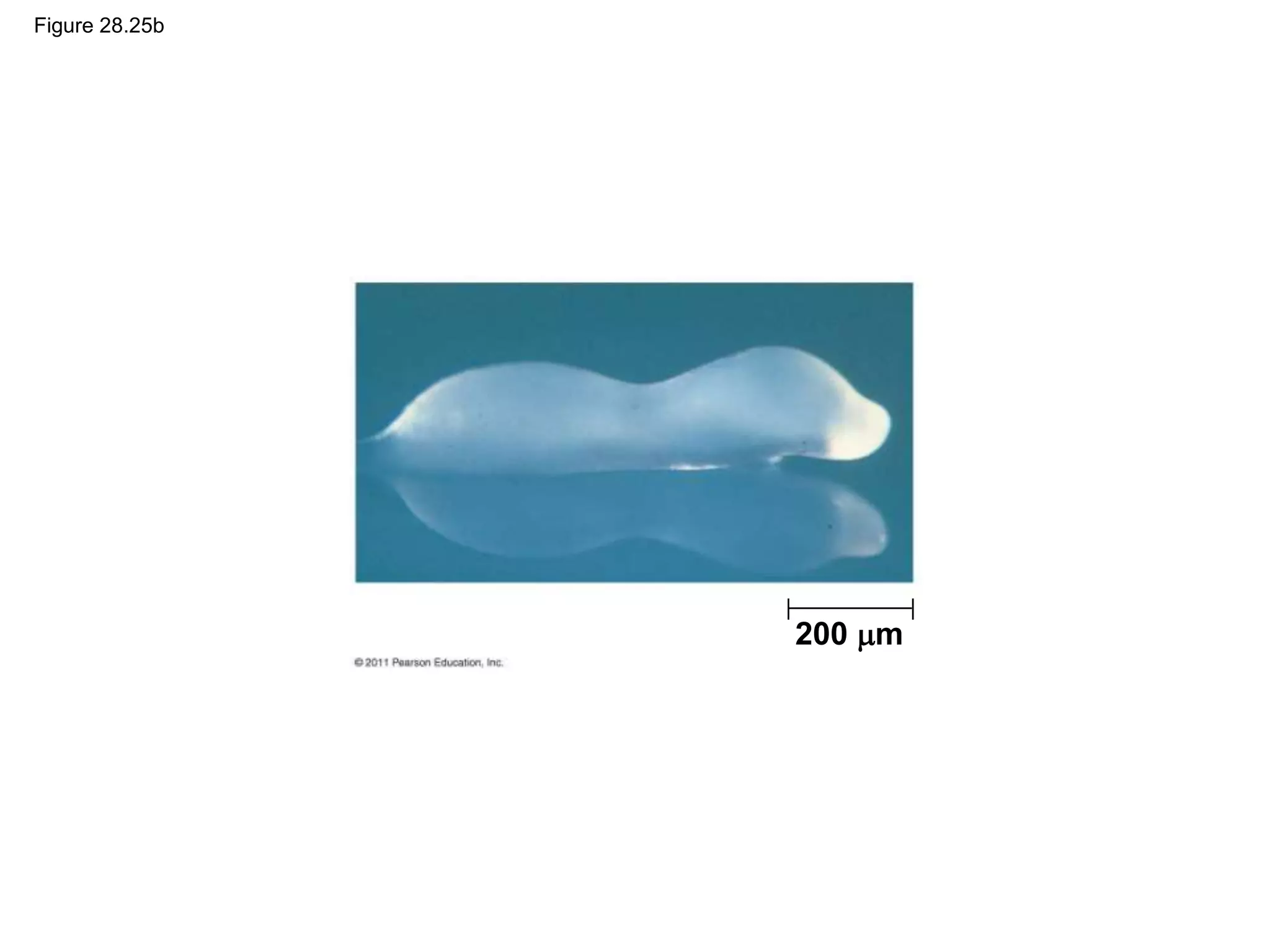 Figure 28.25b
200 m
 