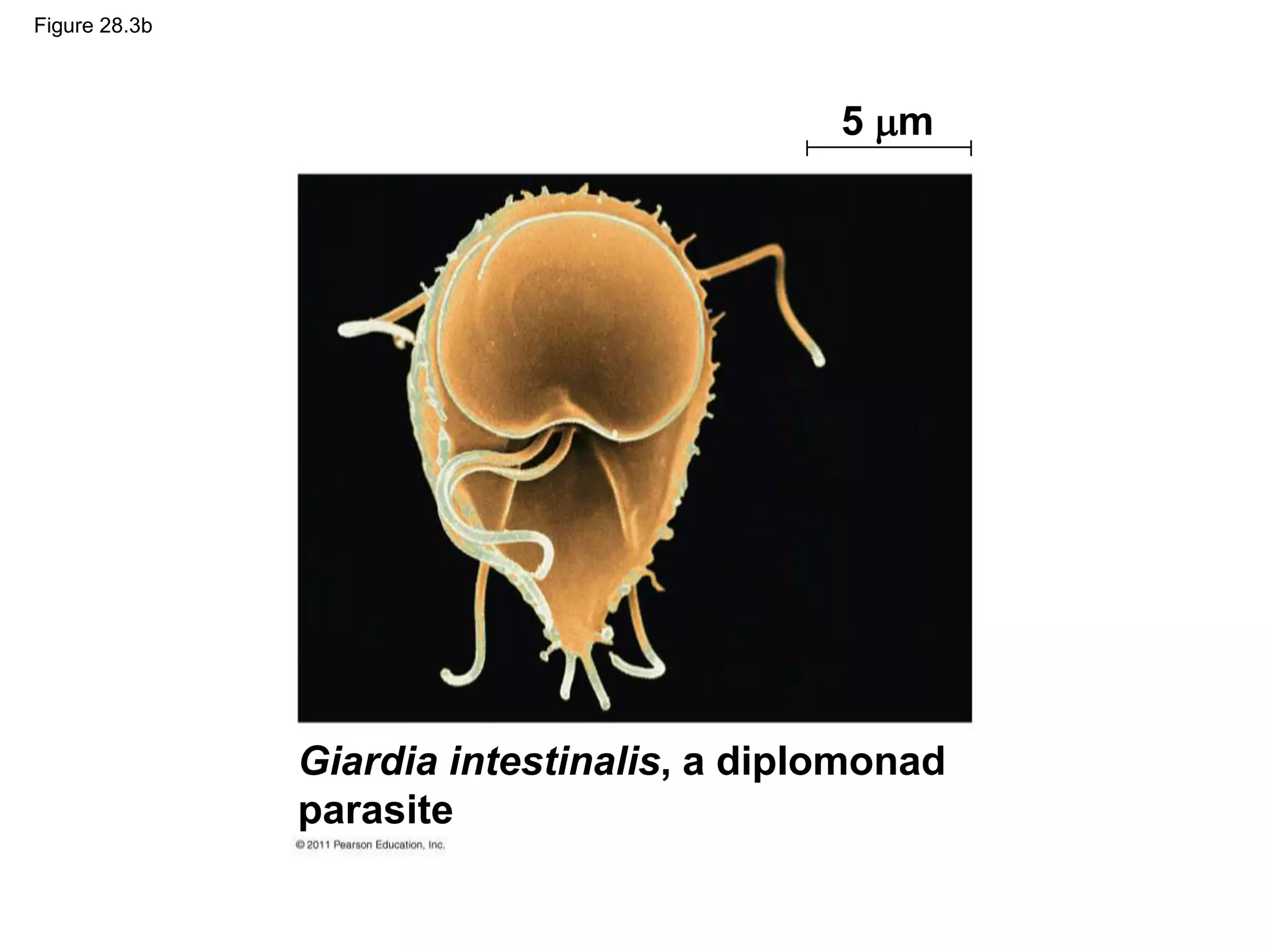 Figure 28.3b
Giardia intestinalis, a diplomonad
parasite
5 m
 