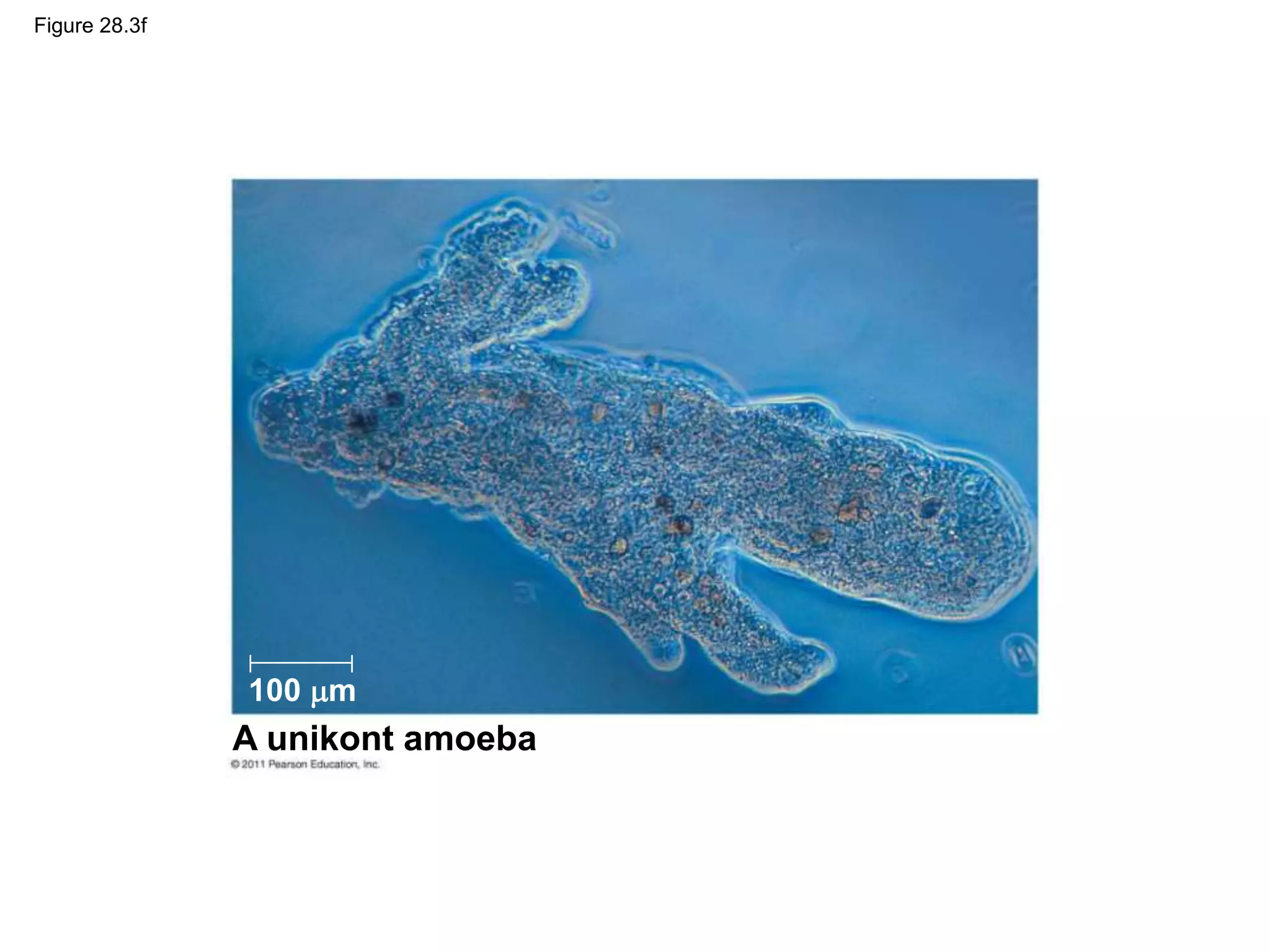Figure 28.3f
A unikont amoeba
100 m
 
