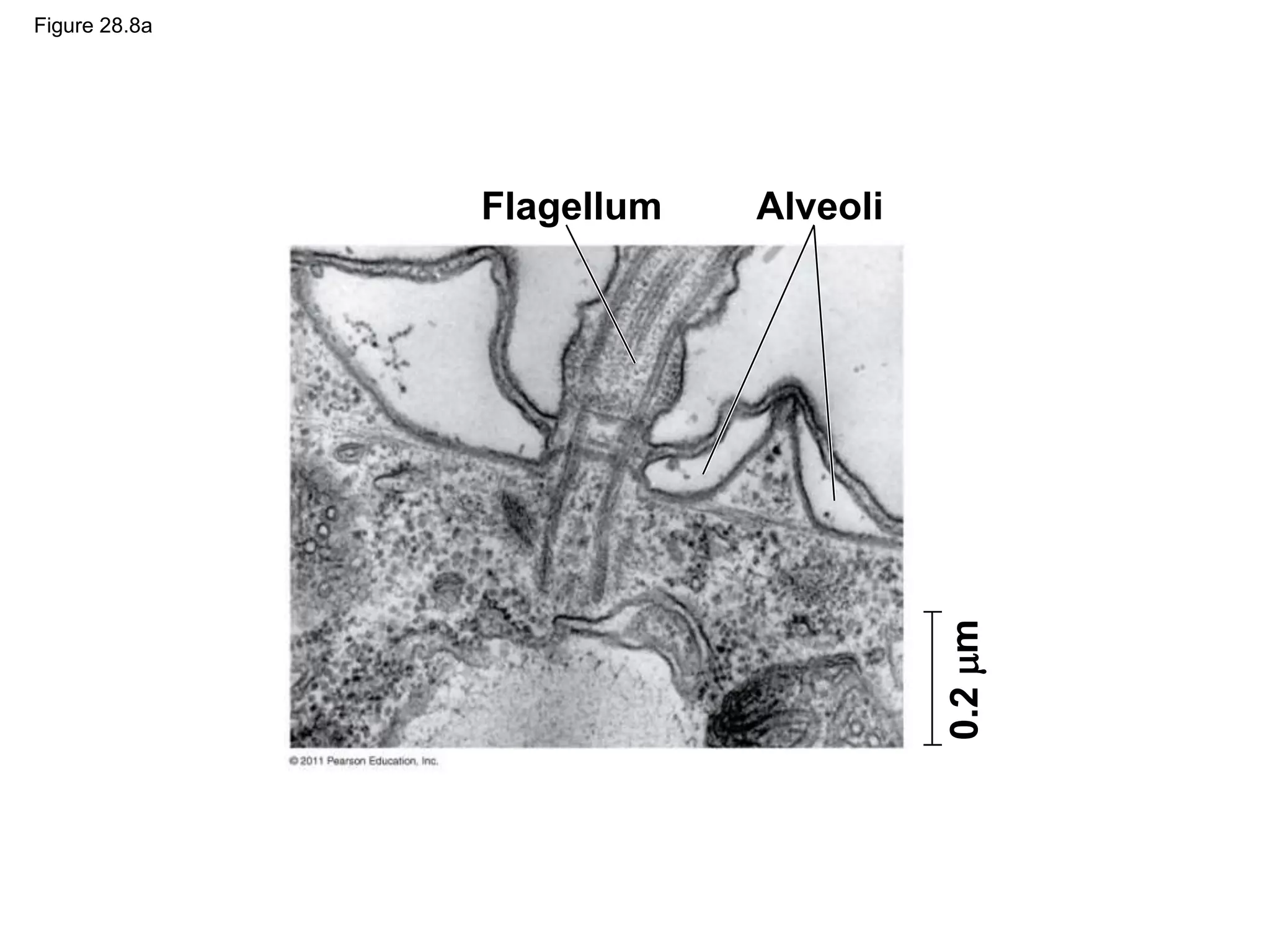 Figure 28.8a
Flagellum Alveoli
0.2
m
 