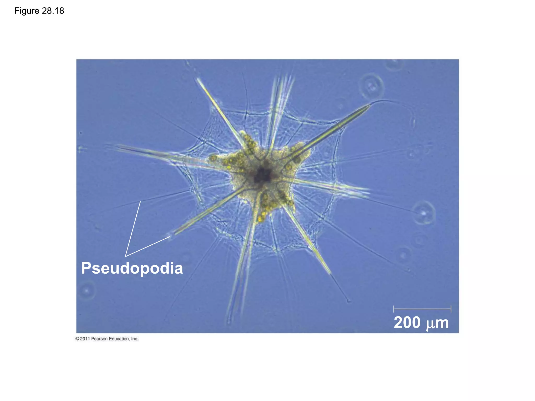 Figure 28.18
Pseudopodia
200 m
 