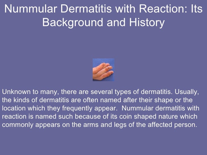 nummular dermatitis with reaction its background and history 2 728