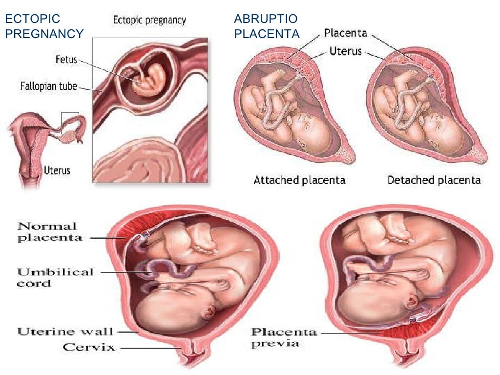 28)Obstetrics And Gynecology
