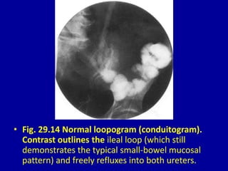 Loopogram Radiograph 29 DAVID SUTTON PICTURES THE UROGENITAL TRACT ANATOMY AND INVESTIGATION ...