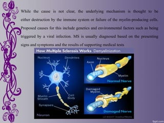 While the cause is not clear, the underlying mechanism is thought to be
either destruction by the immune system or failure of the myelin-producing cells.
Proposed causes for this include genetics and environmental factors such as being
triggered by a viral infection. MS is usually diagnosed based on the presenting
signs and symptoms and the results of supporting medical tests
 