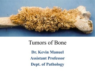 Tumors of Bone
Dr. Kevin Manuel
Assistant Professor
Dept. of Pathology
 
