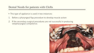Dental Needs for patients with Clefts
 This type of appliance is used in two instances:
1. Before a pharyngeal flap procedure to develop muscle action
2. If the secondary surgical procedures are not successful in producing
velopharyngeal competence.
 