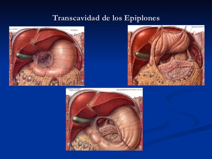 vestibulo de la transcavidad de los epiplones 29 abdomen vestibulo de la transcavidad de los epiplones 29 abdomen