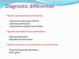 Diagnostic différentiel
Opacités systématisées non rétractiles
-Pneumonie infectieuse (PFLA)
-Infarctus pulmonaire
-Epanchement enkysté inter lobaire
Opacités rétractiles et non systématisées
-Fibrose pulmonaire
-Séquelles de tuberculose
Opacités massives non systématisées et non rétractiles
-Pleurésie de grande abondance
-KHP géant
 