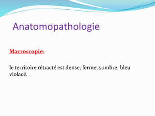 Anatomopathologie
Macroscopie:
le territoire rétracté est dense, ferme, sombre, bleu
violacé.
 