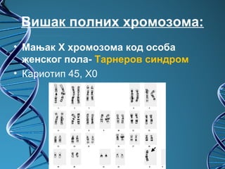 Вишак полних хромозома:
• Мањак X хромозома код особа
  женског пола- Тарнеров синдром
• Кариотип 45, X0
 