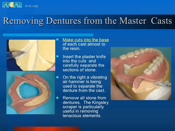29.preparing dentures for delivery