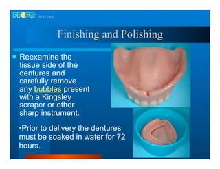 Finishing and Polishing
   Reexamine the
    tissue side of the
    dentures and
    carefully remove
    any bubbles present
    with a Kingsley
    scraper or other
    sharp instrument.
    •Prior to delivery the dentures
    must be soaked in water for 72
    hours.
 