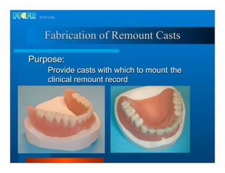 Fabrication of Remount Casts

Purpose:
    Provide casts with which to mount the
    clinical remount record
 