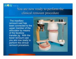 You are now ready to perform the
         clinical remount procedure

 The maxillary
remount cast has
been connected to the
upper member of the
articulator by means
of the facebow
transfer jig. With the
lower remount cast
you are now ready to
perform the clinical
remount procedure.
 