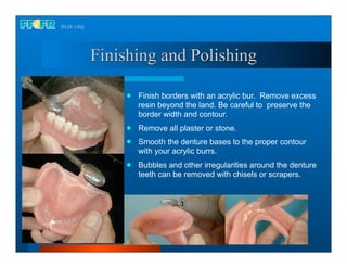 Finishing and Polishing

        Finish borders with an acrylic bur. Remove excess
         resin beyond the land. Be careful to preserve the
         border width and contour.
        Remove all plaster or stone.
        Smooth the denture bases to the proper contour
         with your acrylic burrs.
        Bubbles and other irregularities around the denture
         teeth can be removed with chisels or scrapers.
 