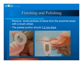 Finishing and Polishing
• Remove small particles of stone from the proximal areas
  with a brush wheel.
• The palatal portion should 1-2 mm thick.
 