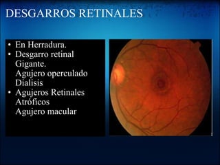 DESGARROS RETINALES En Herradura. Desgarro retinal Gigante. Agujero operculado Dialisis Agujeros Retinales Atróficos Agujero macular 