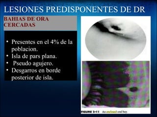 LESIONES PREDISPONENTES DE DR BAHIAS DE ORA CERCADAS     Presentes en el 4% de la poblacion. Isla de pars plana.   Pseudo agujero. Desgarros en borde posterior de isla. 