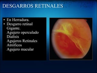 DESGARROS RETINALES En Herradura. Desgarro retinal Gigante. Agujero operculado Dialisis Agujeros Retinales Atróficos Agujero macular   