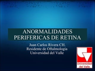ANORMALIDADES PERIFERICAS DE RETINA Juan Carlos Rivera CH. Residente de Oftalmologia  Universidad del Valle  