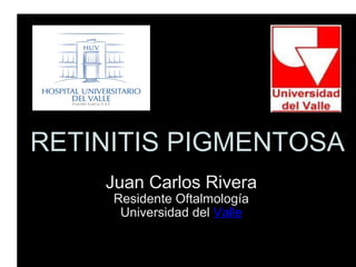 RETINITIS PIGMENTOSA Juan Carlos Rivera Residente Oftalmología Universidad del  Valle 