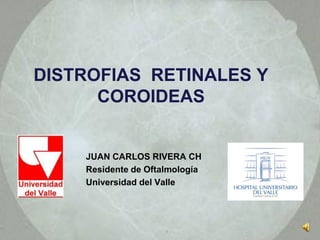 DISTROFIAS RETINALES Y
      COROIDEAS


    JUAN CARLOS RIVERA CH
    Residente de Oftalmología
    Universidad del Valle
 