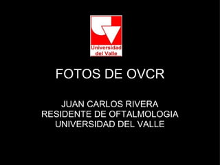 FOTOS DE OVCR JUAN CARLOS RIVERA RESIDENTE DE OFTALMOLOGIA UNIVERSIDAD DEL VALLE 
