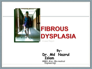 A case Report



                By-
Dr. Md Nazrul
 Islam
MBBS, M.sc. (Bio-medical
  Engineering).
 