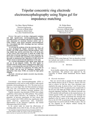 Tripolar concentric ring electrode
electroencephalography using Signa gel for
impedance matching
Ivy Shen, Maciej Walkosz
Electrical Engineering
University of Rhode Island
Kingstown, Rhode Island
Ivy.x.shen.16@dartmouth.edu
Dr. Walter Besio
Electrical Engineering
University of Rhode Island
Kingstown, Rhode Island
Besio@ele.uri.edu
Abstract- Our goal is to develop a high-spatial resolution
and high signal-to-noise electroencephalography (EEG)
recording system. Conventional scalp EEG is contaminated by
noise represented by non-brain electrical activity such as
ocular artifacts, scalp muscle potentials, electrocardiogram,
etc.. Conventional disc EEG recordings also have reference
electrode problems.
To overcome the problems of the disc electrodes (Fig. 1. A)
we have developed the tripolar concentric ring electrode
(TCRE). The TCRE consists of three electrode elements - outer
ring, middle ring, and the central disc (Fig. 1, B). In the past
we have always used Ten20 paste to attach the TCREs and
match skin to electrode impedances. For many electrodes, say
64 or more, it would be time consuming to use Ten20 paste. In
this study we demonstrate that Signa gel on TCREs acts as an
effective means to match electrode impedances to the scalp.
We recorded physiological brain signals using Signa gel
and our 10 mm diameter TCREs. The EEG signals we
recorded with the TCREs (tEEG) originated from alpha wave
activity. A conventional disc electrode (CDE) next to the TCRE
was used to record EEG for comparison. We believe that 10
mm TCREs, and gel used for impedance matching, are
appropriate when many TCREs are needed for high spatial
sampling.
Keywords—electrode gel, tripolar concentric ring electrodes,
TCRE, alpha waves.
I. INTRODUCTION
Conventional scalp electroencephalography (EEG) is
contaminated by noise such as ocular artifacts, scalp muscle
potentials, electrocardiogram, etc., [31]. The noise can be as
large as, or even larger than, the brain potential of interest
[32], [33], [34]. Conventional disc electrode (CDE) EEG
recordings also have reference electrode problems [35].
Tripolar concentric ring electrodes (TCREs) have unique
capabilities which reduce the CDE problems. They perform
the second spatial derivative, the Laplacian, on surface
potentials. In previous experiments we have shown that
EEG recorded with TCREs (tEEG) has significantly better
spatial selectivity, signal-to-noise ratio, localization,
approximation of the analytical Laplacian, and mutual
information than EEG [18]-[20].
In the current study we tested the effectiveness of
recording alpha waves with 10 mm., 6.0 mm, and 4.0 mm
diameter TCREs using Signa gel. Next we describe in detail
our methods and results as well as a discussion about the
results and our conclusion.
II. METHODS
A. Subjects
Seven healthy subjects (four women) were recruited for
the experiments. The protocol was approved by the
University of Rhode Island Institutional Review Board
(IRB).
B. Electrode Attachment
Hair was moved aside to prepare for the electrode and
then NuPrep abrasive gel (D. O. Weaver, Aurora, CO) was
used to remove oil and dry skin. Four electrodes were
attached to the scalp. As shown in Fig. 2. one 10 mm, 6 mm,
or 4 mm diameter TCRE was placed on the occipital lobe in
the O2 area with Signa gel (Parker Labs) used for skin-to-
electrode impedance matching. The reference electrode was
a CDE attached with ten20 paste on the mastoid process. An
isolated ground (CDE) was secured to the forehead also
using ten20 paste. A third conventional disc electrode was
attached in the O2 region of the scalp using ten20 paste.
Next to the O2 CDE we positioned a TCRE with Signa gel.
Surgical tape was used to hold the TCREs in place. This set
up was repeated on all subjects without varying the
placement of electrodes.
We would like to thank the National Science Foundation (NSF) for
award IIP-1248654 to WGB. The content is solely the responsibility of the
authors and does not represent the official views of the NSF.
Fig. 1. Conventional disc electrode (A) and tripolar concentric ring
electrode (B).
978-1-4799-3728-8/14/$31.00 ©2014 IEEE
 