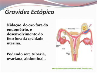 Gravidez Ectópica
Nidação do ovo fora do
endométrio, e
desenvolvimento do
feto fora da cavidade
uterina.
Podendo ser: tubária,
ovariana, abdominal .
www.guiaembarazo.com/hemorragias_durante_part...
 