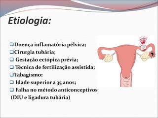 Etiologia:
Doença inflamatória pélvica;
Cirurgia tubária;
 Gestação ectópica prévia;
 Técnica de fertilização assistida;
Tabagismo;
 Idade superior a 35 anos;
 Falha no método anticonceptivos
(DIU e ligadura tubária)
 