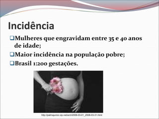 Incidência
Mulheres que engravidam entre 35 e 40 anos
de idade;
Maior incidência na população pobre;
Brasil 1:200 gestações.
http://palmajunior.zip.net/arch2008-03-01_2008-03-31.html
 