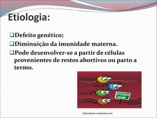 Etiologia:
Defeito genético;
Diminuição da imunidade materna.
Pode desenvolver-se a partir de células
provenientes de restos abortivos ou parto a
termo.
Diarioaberto.wordpress.com
 