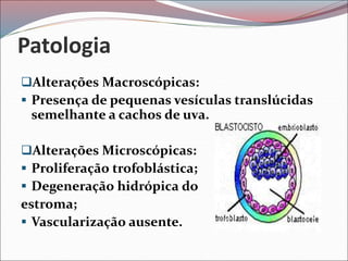 Patologia
Alterações Macroscópicas:
 Presença de pequenas vesículas translúcidas
semelhante a cachos de uva.
Alterações Microscópicas:
 Proliferação trofoblástica;
 Degeneração hidrópica do
estroma;
 Vascularização ausente.
 