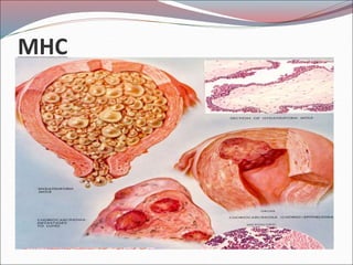 MHC
1. www.zanbom.es/...3/mujer/atlas/fichas.1162.htm
 