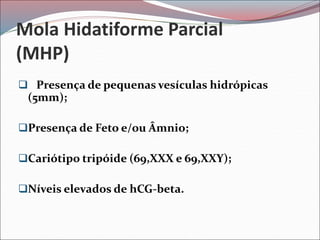 Mola Hidatiforme Parcial
(MHP)
 Presença de pequenas vesículas hidrópicas
(5mm);
Presença de Feto e/ou Âmnio;
Cariótipo tripóide (69,XXX e 69,XXY);
Níveis elevados de hCG-beta.
 