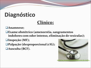 Diagnóstico
Clínico:
Anamnese;
Exame obstétrico (amenorréia, sangramentos
indolores com odor intenso, eliminação de vesículas);
Inspeção (MF);
Palpação (desproporcional à IG);
Ausculta (BCF).
orthofree.blogspot.com/2008/05/curso-de-medic...
 